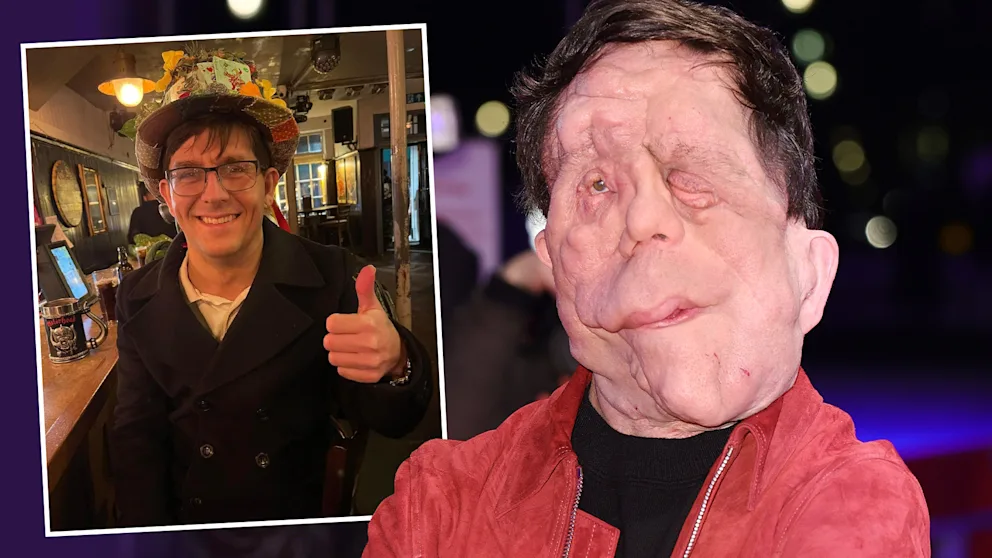 Adam Pearson Krankheit